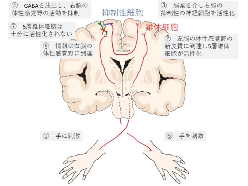 半球間抑制